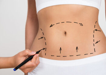 Hoại tử, nhiễm trùng nặng sau ca phẫu thuật biến eo ‘bánh mỳ’ thành búp bê